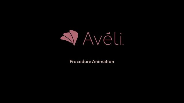 Say goodbye to stubborn cellulite!  We're excited to introduce Aveli, our new surgical procedure for smoother, more confident skin.⁠
⁠
Aveli is minimally invasive and offers long-lasting results.  Want to know if Aveli is right for you?  Let us know in the comments below or call us to schedule a consultation at ☎️ (310) 784-0644!  #SouthBayPlasticSurgeons #Aveli #CelluliteTreatment #GoodbyeDimples #HelloSmoothSkin #SummerBody #NewProcedure #Consultation #FeelingConfident⁠
⁠
What are your questions about Avelle?  We're here to spill the tea (and help you achieve your dream bod!)