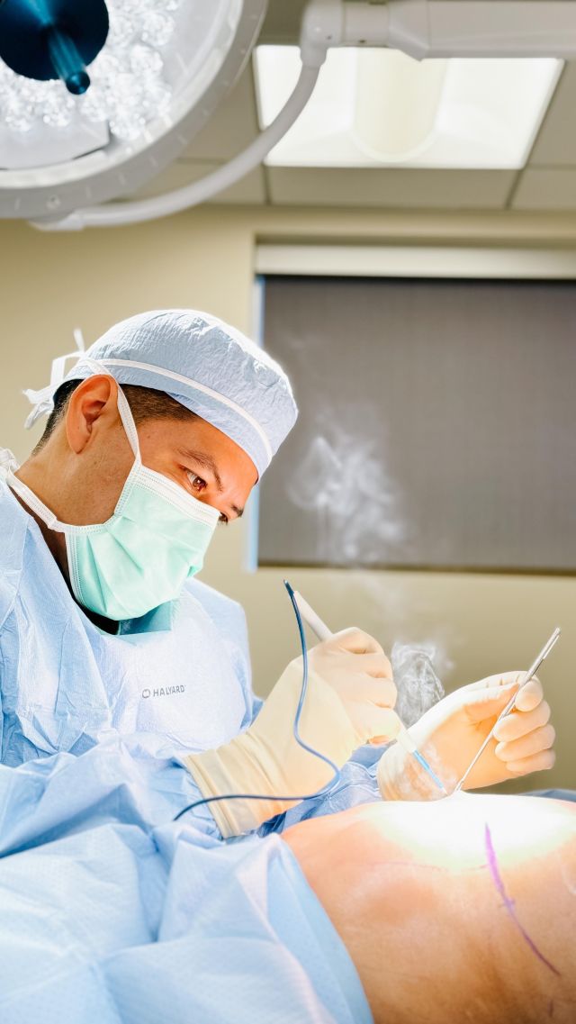 At South Bay Plastic Surgeons, we strive to minimize risks and deliver natural, and beautiful results. We have helped hundreds of women through breast augmentation surgery, and it is one of the most common procedures we perform!⁠
⁠
To ensure a personalized fit and proper placement/symmetry, our board-certified plastic surgeons utilize sterilized sizers during surgery. This allows us to try on different sizes so we can make sure we are meeting our patients’ expectations. We take this extra step to ensure patient satisfaction because every detail matters, and every decision is tailored to you!⁠
⁠
Are you interested in breast augmentation? Call us at 310-784-0644 to schedule today!⁠
⁠
#breastaugmentation #sbps #southbayplasticsurgeons⁠