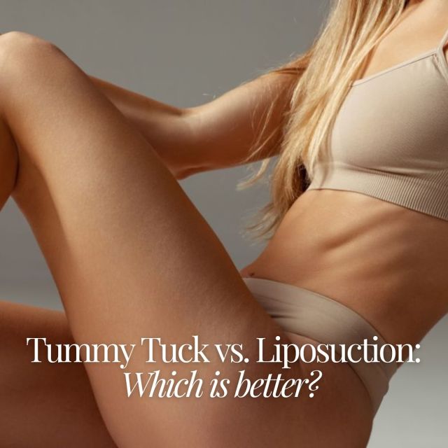 TUMMY TUCK VS LIPOSUCTION: WHICH IS BETTER?⁠
⁠
Are you dealing with diet and exercise-resistant fat or excess skin? At South Bay Plastic Surgeons, our board-certified plastic surgeons work with patients to select the ideal body contouring method and create a customized surgical plan. ⁠
⁠
Click the link in bio to read our blog post regarding the similarities and differences of each procedure, the benefits of tummy tucks and liposuction, and who is the ideal candidate for surgery.⁠
⁠
#southbayplasticsurgeons #sbps #bodycontouring